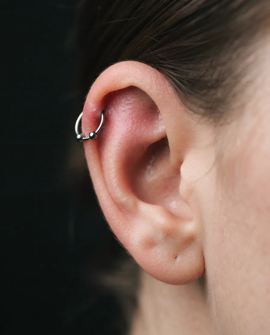 Helix, titanium
